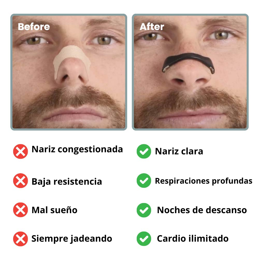 Breath Pro™ Magnetic Nasal Dilator